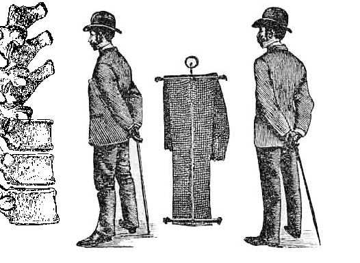 pantalune spine